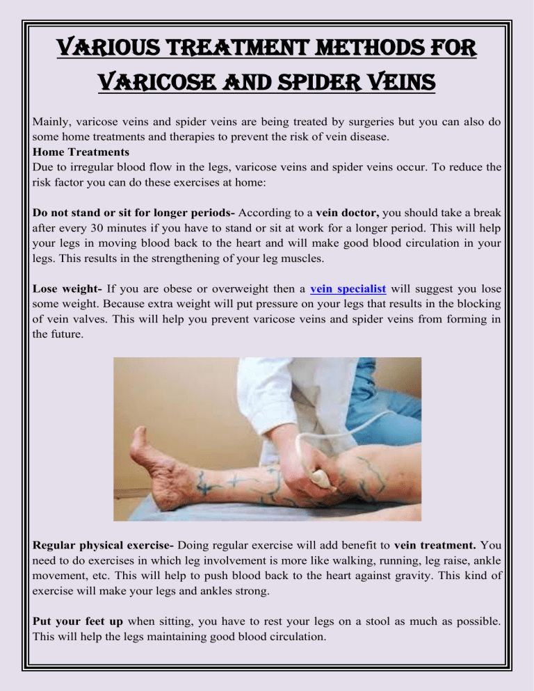 Exercises for varicose veins in legs pdf