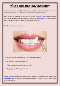 What are Dental Veneers