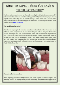 What to expect when you have a tooth extraction