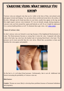 Varicose veins  What Should You Know