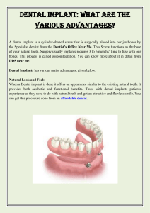 Dental Implant What Are The Various Advantages