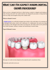 What Can You Expect During Dental Crown Procedure