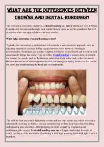 What Are the differences Between Crowns and Dental Bondings