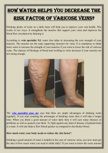 How water helps you decrease the risk factor of varicose veins