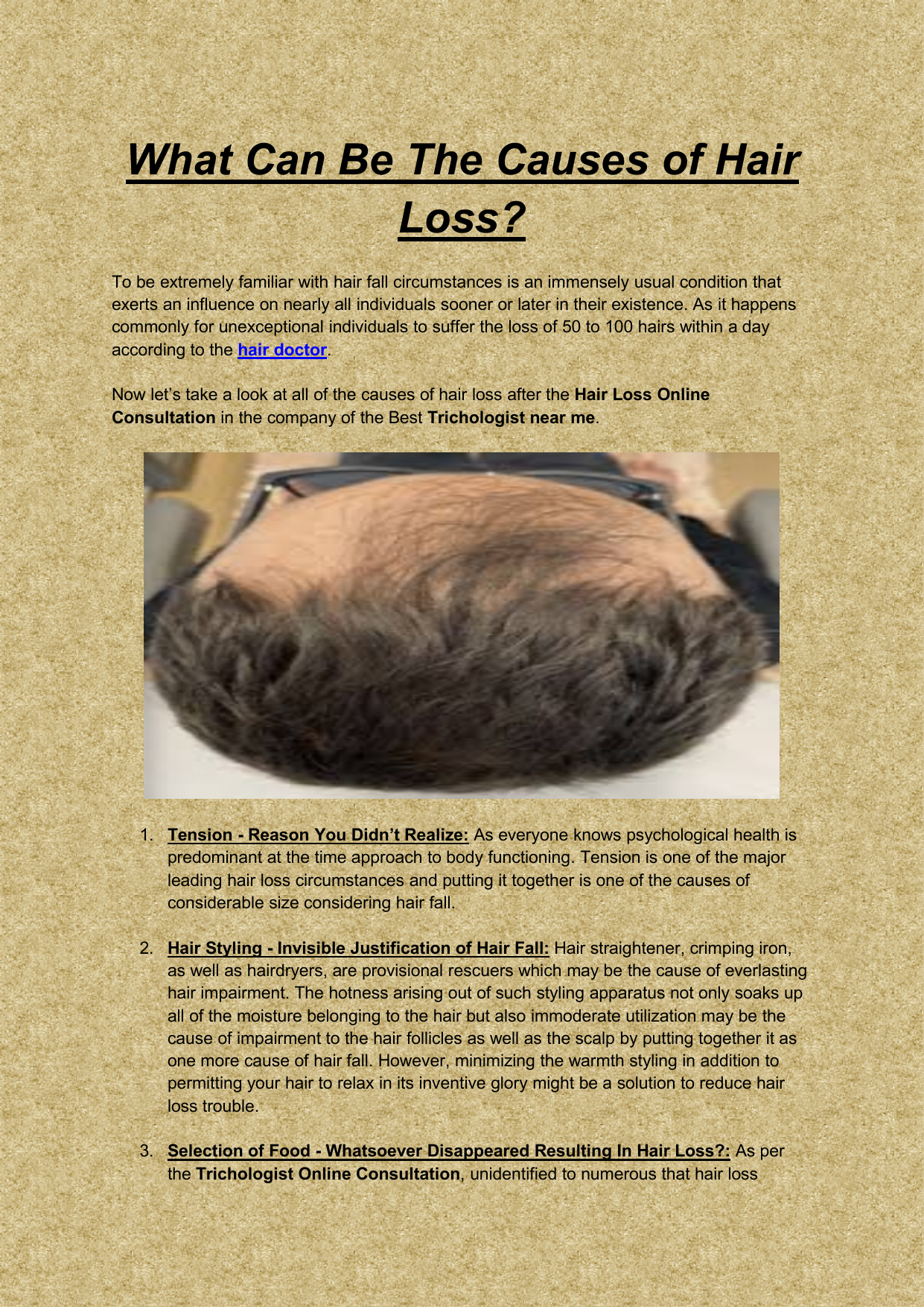 What Can Be The Causes of Hair Loss