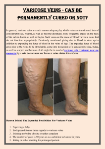 Varicose Veins  Can Be Permanently Cured Or Not