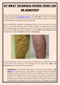 By What Technique Spider Veins Can Be Removed