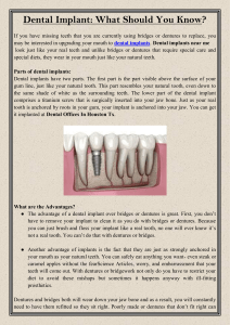 Dental Implant What Should You Know