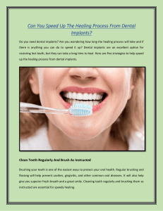 Can You Speed Up The Healing Process From Dental Implants