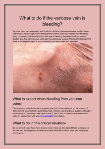 What to do if the varicose vein is bleeding