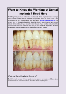Want to Know the Working of Dental Implants Read Here