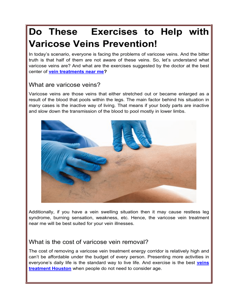 Do These Exercises to Help with Varicose Veins Prevention!