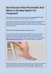 Are Varicose Veins Preventable And Which is the Best Option For Treatment