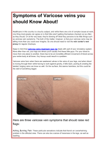 Symptoms of Varicose veins you should Know About!