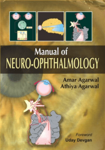 Agarwal-Manual-of-Neuro-Ophthalmogy