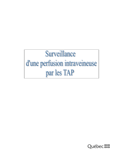 Perfusion et surveillance