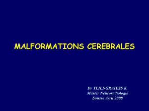 vdocuments.mx malformations-cerebrales-dr-tlili-graiess-k-master-neuroradiologie-sousse-avril-2008