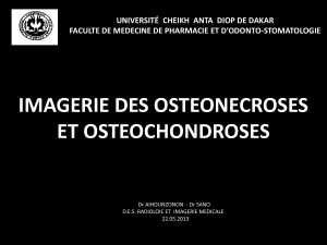 OSTEONECROSES ET OSTEOCHONDROSES-1
