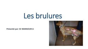 brulures