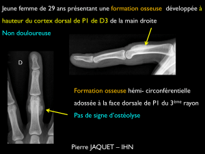 Tumeur de Nora : Présentation de cas et diagnostic