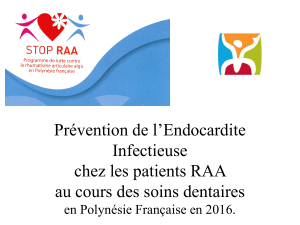 prevention ei soins dentaires chaumel epu raa 20161027