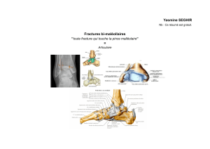 Fractures bi-malléolaires : résumé de cours