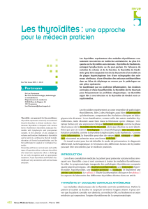 Thyroïdites : Approche pour le praticien