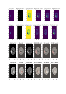 Analyse de segmentation de tumeurs cérébrales