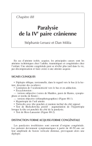 Paralysie du IVe nerf crânien : Diagnostic et causes