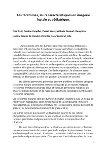 Tératomes fœtaux et pédiatriques : Imagerie et caractéristiques