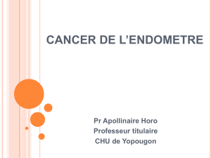 Cancer de l'endomètre : Facteurs, Diagnostic et Traitement