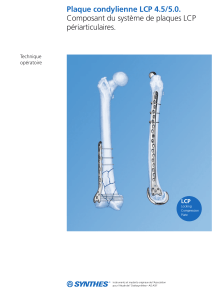 Plaque LCP condylienne 4.5-5.0 - Technique opÃ©ratoire.pdf - Synthes (1)