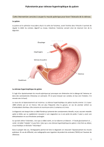 pylorotomie