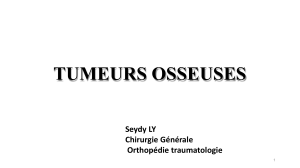 Tumeurs Osseuses: Diagnostic, Classification et Traitement en Orthopédie