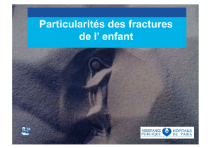 Particularités des fractures de l'enfant : Généralités et Classification