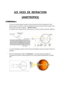 Vices de Réfraction (Amétropies) : Myopie, Hypermétropie, Astigmatisme, Presbytie