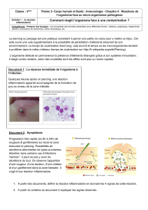 T3-Chap4-Act 1 La r&eacute;action inflammatoire