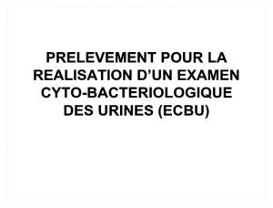 Urine Cytobacteriological Examination (ECBU) Collection Guide