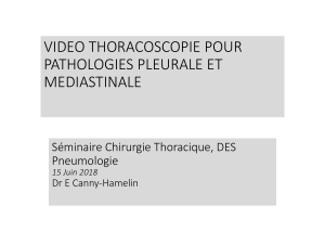 Vid&eacute;o-thoracoscopie pour pathologies pleurale et m&eacute;diastinale