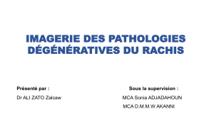 Imagerie des pathologies d&eacute;g&eacute;n&eacute;ratives du rachis