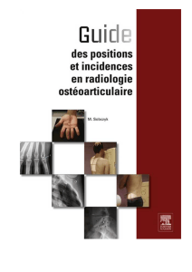 Guia de Posicionamento Radiol&oacute;gico: Incid&ecirc;ncias Osteoarticulares