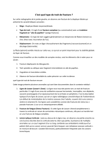 Types de traits de fracture : Analyse radiologique