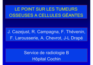 Tumeurs osseuses &agrave; cellules g&eacute;antes : Point sur le diagnostic et le traitement