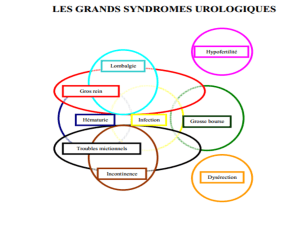 Diagnostic d'une grosse bourse : urologie
