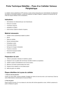 Fiche Technique : Pose d'un Cath&eacute;ter Veineux P&eacute;riph&eacute;rique