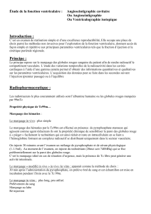 &Eacute;tude de la fonction ventriculaire : Angioscintigraphie cavitaire