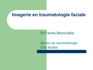 Imagerie en traumatologie faciale : fractures et imagerie