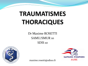 Pr&eacute;sentation Traumatismes Thoraciques