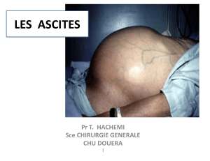 Ascites : D&eacute;finition, Physiologie et Diagnostic