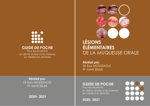 Guide de poche : L&eacute;sions &eacute;l&eacute;mentaires de la muqueuse orale